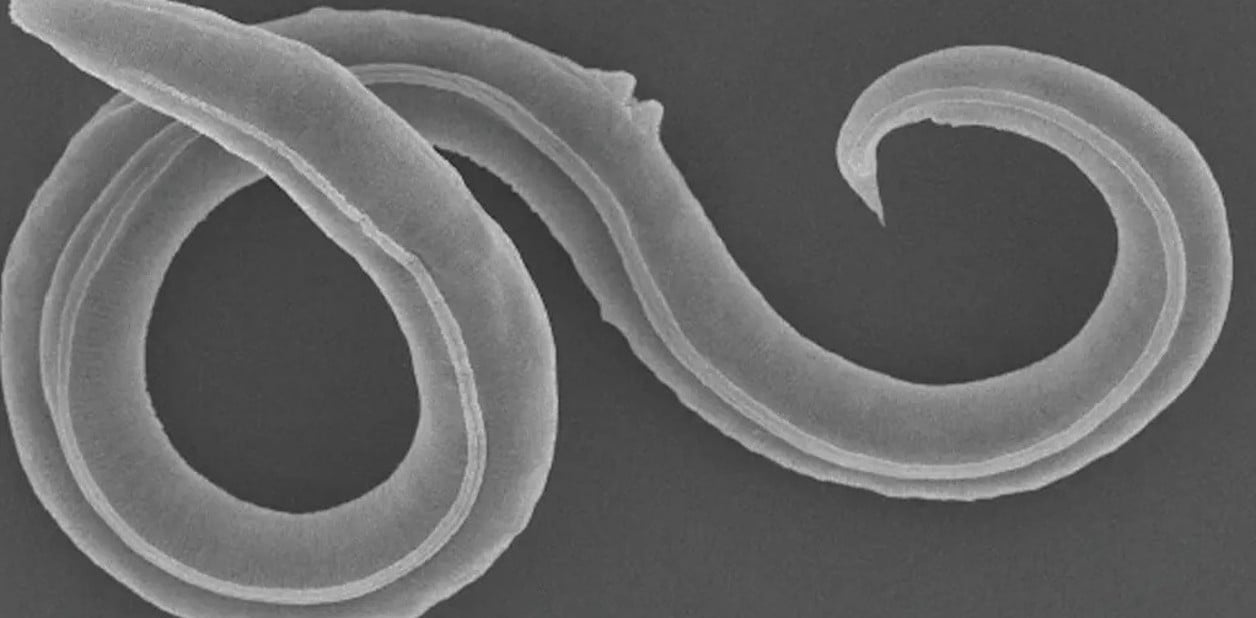 Imagen electrónica de barrido de una hembra del nematodo Panagrolaimus kolymaensis.
